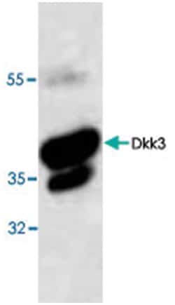 Dkk3, Rabbit, Polyclonal Antibody, Abnova 100&mu;g; Unlabeled:Antibodies,