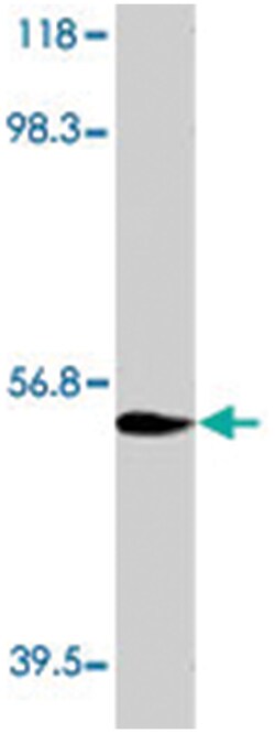 Il8rb, Rabbit, Polyclonal Antibody, Abnova 100&mu;g; Unlabeled:Antibodies,