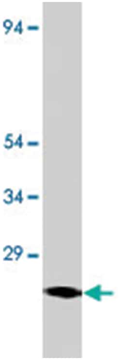 LOC677879 (Fel D1) Rabbit anti-Cat, Polyclonal Antibody, Abnova 100&mu;g;