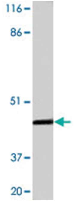 INHA Rabbit anti-Human, Mouse, Rat, Polyclonal Antibody, Abnova 100&mu;g;