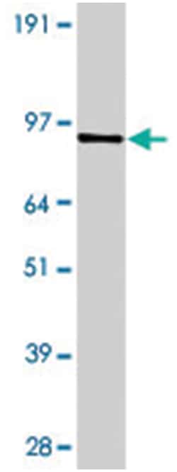 Pde7b, Rabbit, Polyclonal Antibody, Abnova 100&mu;g; Unlabeled:Antibodies,