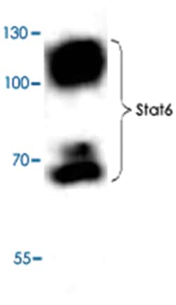 STAT6 Rabbit anti-Human, Mouse, Rat, Polyclonal Antibody, Abnova 100 &mu;g | Buy Online | Abnova Corporation | Fisher Scientific