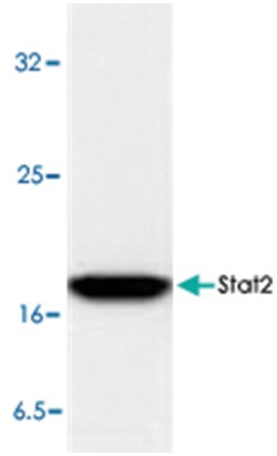BIRC5 Rabbit anti-Human, Polyclonal Antibody, Abnova 100&mu;g; Unlabeled:Antibodies,
