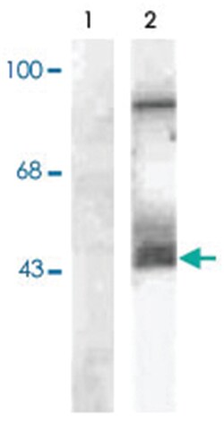MAP2K1/MAP2K2 (phospho S218/S222), Rabbit, Polyclonal Antibody, Abnova