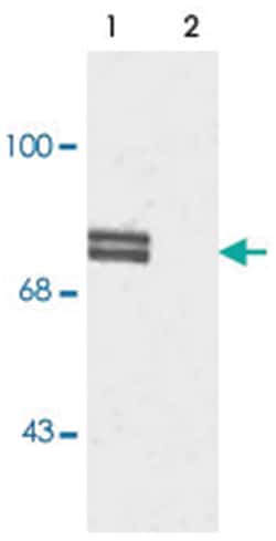 ALOX5 (phospho S523), Rabbit, Polyclonal Antibody, Abnova 100 &mu;L | Buy Online | Abnova | Fisher Scientific