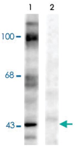 EphrinB (phospho Y317), Rabbit, Polyclonal Antibody, Abnova 100 &mu;L | Buy Online | Abnova Corporation | Fisher Scientific