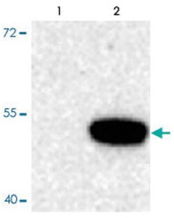 TPH1 (phospho S58), Rabbit, Polyclonal Antibody, Abnova 100 &mu;L | Buy Online | Abnova | Fisher Scientific