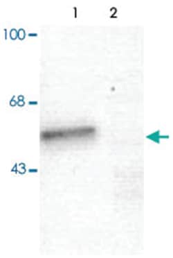 Gabra1 Rabbit anti-Bovine, Dog, Human, Mouse, Primates, Rat, Polyclonal Antibody, Abnova 100 &mu;L | Buy Online | Abnova Corporation | Fisher Scientific