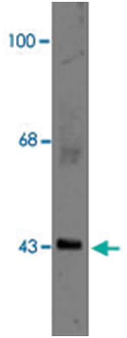 Gja1 Rabbit anti-Chicken, Clawed frog, Dog, Human, Mouse, Primates, Rat, Sheep, Zebra fish, Polyclonal Antibody, Abnova 100 &mu;L | Buy Online | Abnova | Fisher Scientific