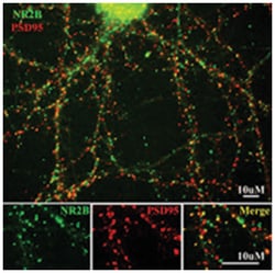 Grin2b Rabbit anti-Bovine, Chicken, Dog, Human, Mouse, Primates, Rat, Polyclonal