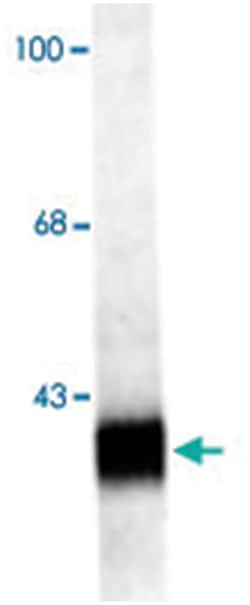 Synpr, Rabbit, Polyclonal Antibody, Abnova 100 &mu;L | Buy Online | Abnova Corporation | Fisher Scientific