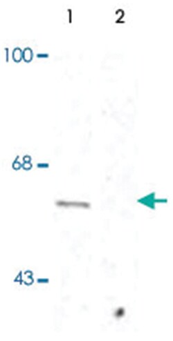 synaptotagmin (phospho S309), Rabbit, Polyclonal Antibody, Abnova 100 &mu;L | Buy Online | Abnova Corporation | Fisher Scientific