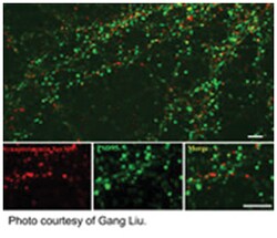 synaptotagmin (phospho S309), Rabbit, Polyclonal Antibody, Abnova 100 &mu;L | Buy Online | Abnova Corporation | Fisher Scientific