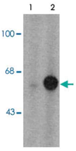 TH (phospho S31), Rabbit, Polyclonal Antibody, Abnova 100 &mu;L | Buy Online | Abnova Corporation | Fisher Scientific