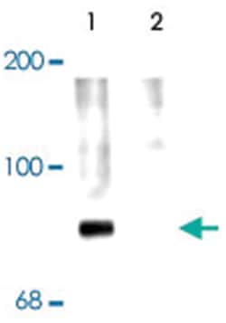 SYN1 (phospho S62/S67), Rabbit, Polyclonal Antibody, Abnova 100 &mu;L | Buy Online | Abnova | Fisher Scientific