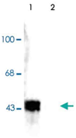 ERK/MAPK (phospho T202/Y204), Rabbit, Polyclonal Antibody, Abnova 100&mu;L;