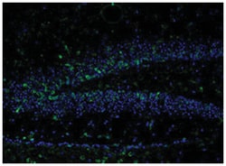 Grin2b (phospho Y1336), Rabbit anti-Human, Mouse, Rat, Polyclonal Antibody,