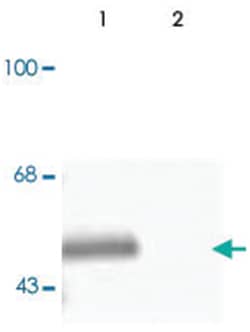 Gabra3, Rabbit, Polyclonal Antibody, Abnova 100&mu;L; Unlabeled:Antibodies,
