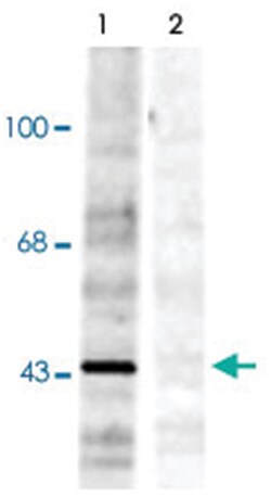EphrinB (phospho Y298), Rabbit, Polyclonal Antibody, Abnova 100 &mu;L | Buy Online | Abnova | Fisher Scientific