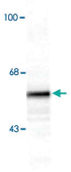 TH, Sheep, Polyclonal Antibody, Abnova 100 &mu;L | Buy Online | Abnova Corporation | Fisher Scientific