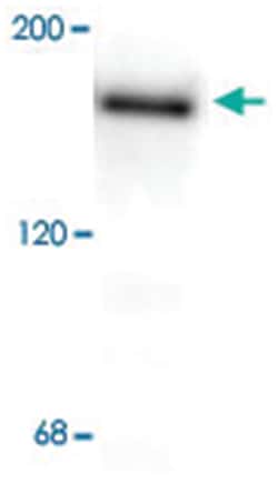 Grin2b Rabbit anti-Human, Mouse, Rat, Polyclonal Antibody, Abnova 10&mu;g;