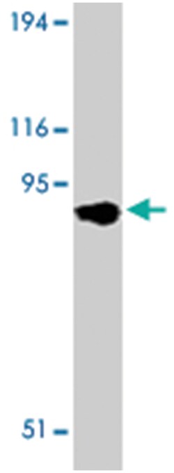 Tlr11 Rabbit anti-Mouse, Polyclonal Antibody, Abnova 100&mu;g; Unlabeled:Antibodies,