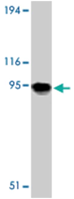 Tlr11 Rabbit anti-Mouse, Polyclonal Antibody, Abnova 100&mu;g; Unlabeled:Antibodies,