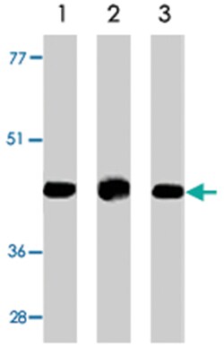 CASP13, Rabbit, Polyclonal Antibody, Abnova 100 &mu;g | Buy Online | Abnova Corporation | Fisher Scientific