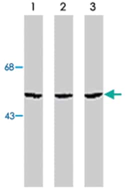 CHEK1, Sheep, Polyclonal Antibody, Abnova 250 &mu;g | Buy Online | Abnova Corporation | Fisher Scientific