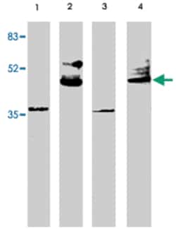 VSX2 Sheep anti-Human, Mouse, Rat, Polyclonal Antibody, Abnova 250&mu;g;