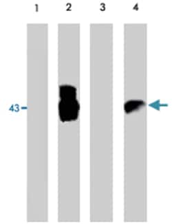 EIA, Sheep, Polyclonal Antibody, Abnova 100&mu;g; Unlabeled:Antibodies,