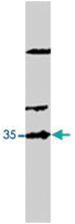 Cacng2 Rabbit anti-Human, Rat, Polyclonal Antibody, Abnova 100 &mu;g | Buy Online | Abnova | Fisher Scientific