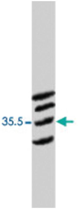 Cacng3, Rabbit, Polyclonal Antibody, Abnova 100&mu;g; Unlabeled:Antibodies,