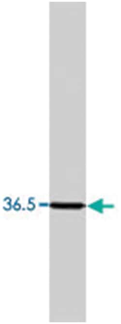 Cacng4, Rabbit, Polyclonal Antibody, Abnova 100&mu;g; Unlabeled:Antibodies,