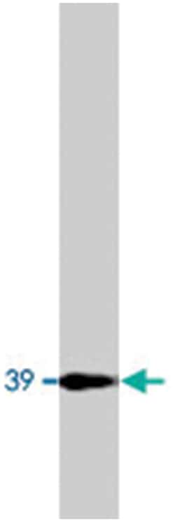 GNAI1/GNAI2, Rabbit, Polyclonal Antibody, Abnova 100 &mu;g | Buy Online | Abnova | Fisher Scientific