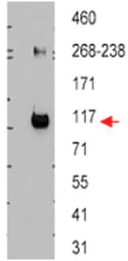 ABCB5 Rabbit anti-Human, Polyclonal Antibody, Abnova 100&mu;g; Unlabeled:Antibodies,
