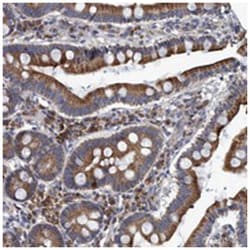 NAT16, Rabbit, Polyclonal Antibody, Abnova 100 &mu;L | Buy Online | Abnova Corporation | Fisher Scientific
