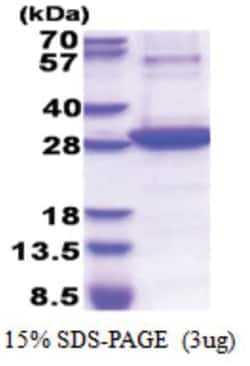 Novus Biologicals Recombinant Human 5'-Nucleotidase/CD73 His Protein 0.25 mg | Buy Online | Novus Biologicals&trade; | Fisher Scientific