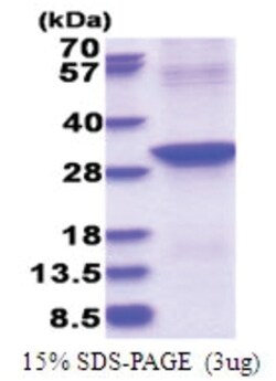 Novus Biologicals&trade;&nbsp;Recombinant Human ABHD12B His Protein