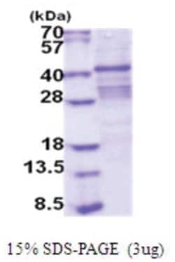 Novus Biologicals&trade;&nbsp;Recombinant Human ACP2 His Protein
