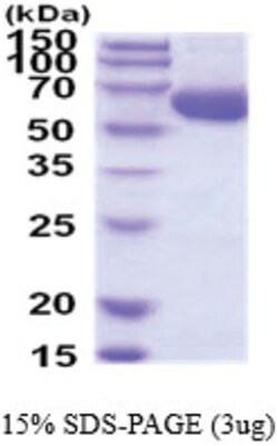 Novus Biologicals&trade;&nbsp;Recombinant Human ACSF2 His Protein