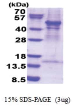Novus Biologicals Recombinant Human ACTR3 His Protein 0.1 mg | Buy Online | Novus Biologicals&trade; | Fisher Scientific