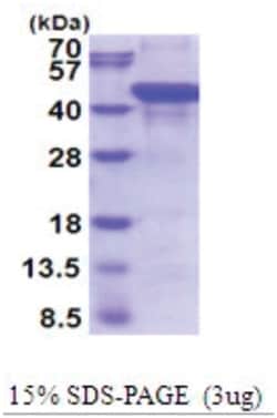Novus Biologicals&trade;&nbsp;Recombinant Human AGA His Protein