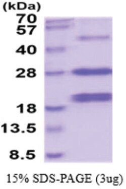 Novus Biologicals&trade;&nbsp;Recombinant Human AGA His Protein