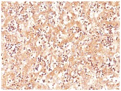 alpha-Fetoprotein/AFP Mouse, Clone: SPM334, Novus Biologicals 0.2mg; Unlabeled:Antibodies,