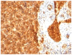 alpha-Fetoprotein/AFP Mouse, Clone: SPM334, Novus Biologicals 0.2mg; Unlabeled:Antibodies,