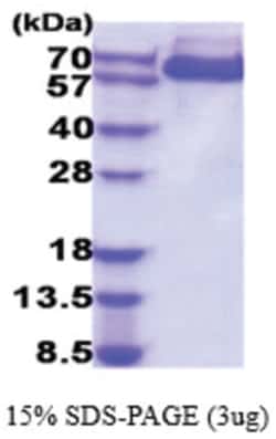 Novus Biologicals Recombinant Human alpha-Fetoprotein/AFP His Protein 0.05 mg | Buy Online | Novus Biologicals&trade; | Fisher Scientific