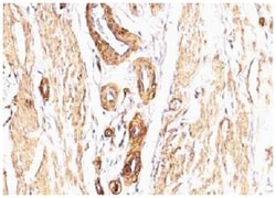 alpha-Smooth Muscle Actin Mouse, Clone: SPM332, Novus Biologicals 0.2mg;