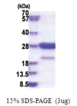 Novus Biologicals&trade;&nbsp;Recombinant Human Amisyn His Protein