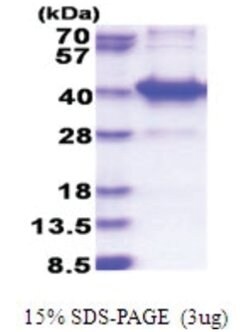 Novus Biologicals&trade;&nbsp;Recombinant Human AMMECR1L His Protein
